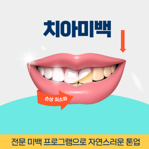 평택치과 평택시 치과 치아미백